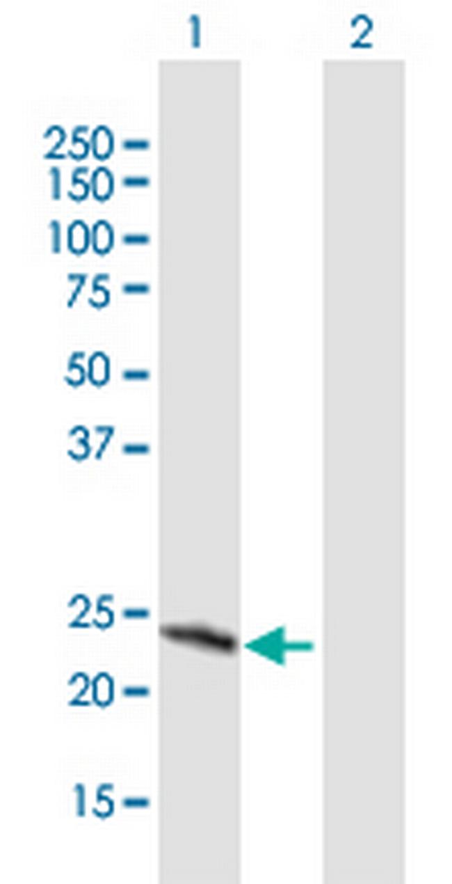 SRY Antibody in Western Blot (WB)