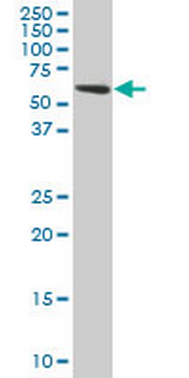 TROVE2 Antibody in Western Blot (WB)