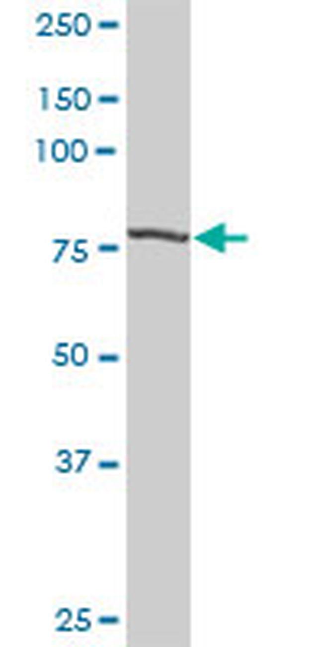 STAT1 Antibody in Western Blot (WB)