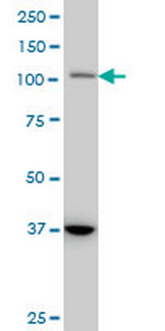 STAT2 Antibody in Western Blot (WB)