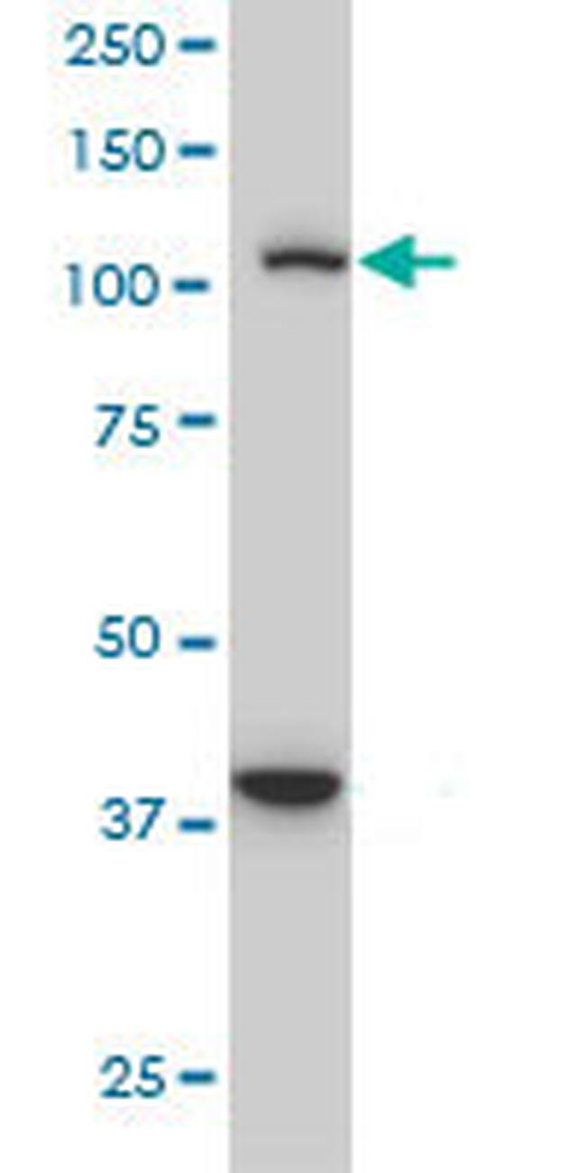 STAT2 Antibody in Western Blot (WB)