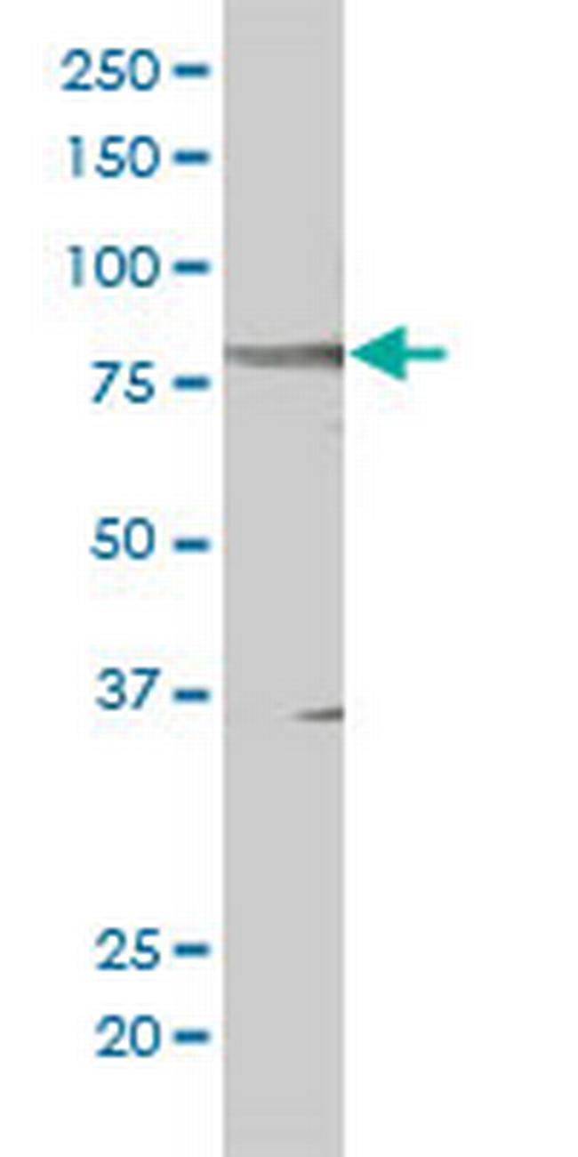 STAT5B Antibody in Western Blot (WB)