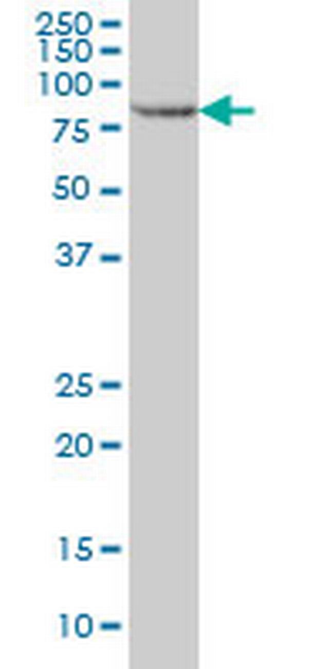 STAT5B Antibody in Western Blot (WB)