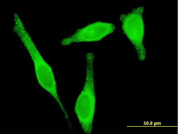 STAU1 Antibody in Immunocytochemistry (ICC/IF)