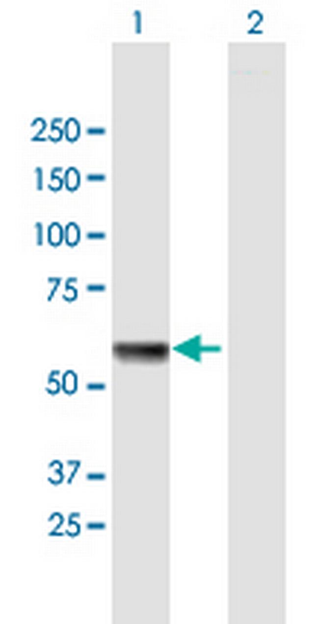 HSPA13 Antibody in Western Blot (WB)