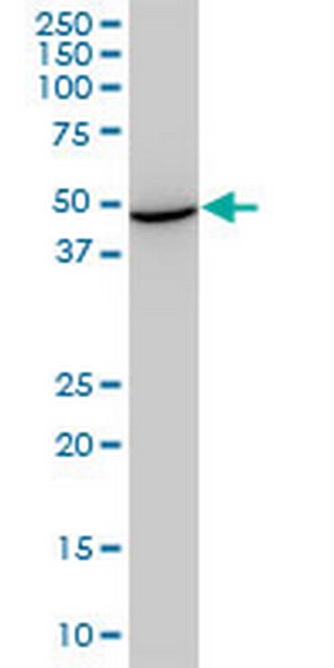 STCH Antibody in Western Blot (WB)