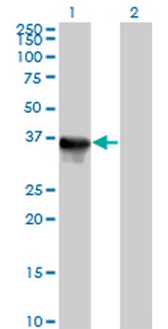 SULT1E1 Antibody in Western Blot (WB)