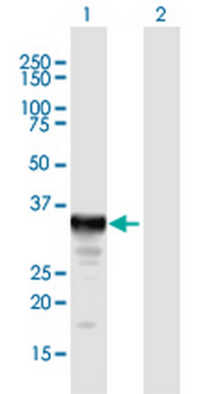 SULT1E1 Antibody in Western Blot (WB)