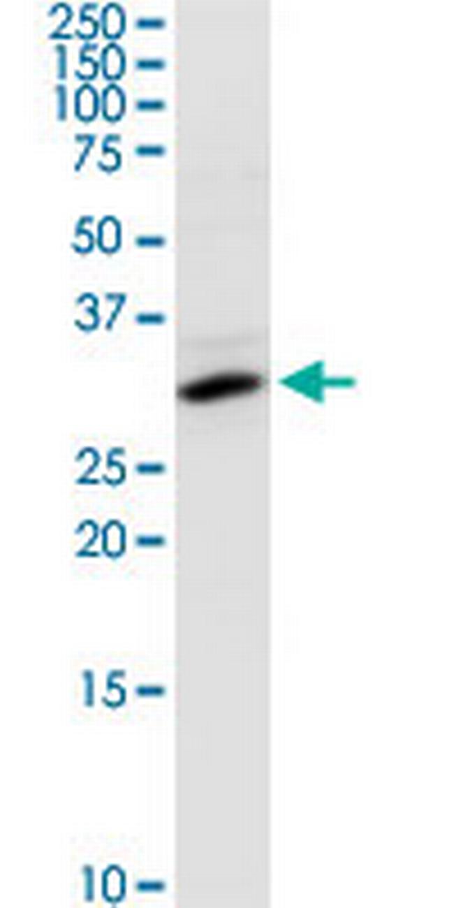 SULT1E1 Antibody in Western Blot (WB)