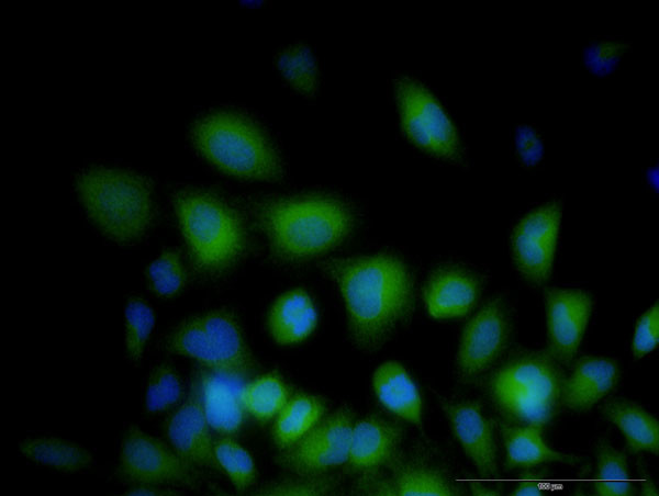 STIM1 Antibody in Immunocytochemistry (ICC/IF)