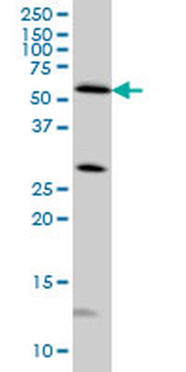 STK4 Antibody in Western Blot (WB)