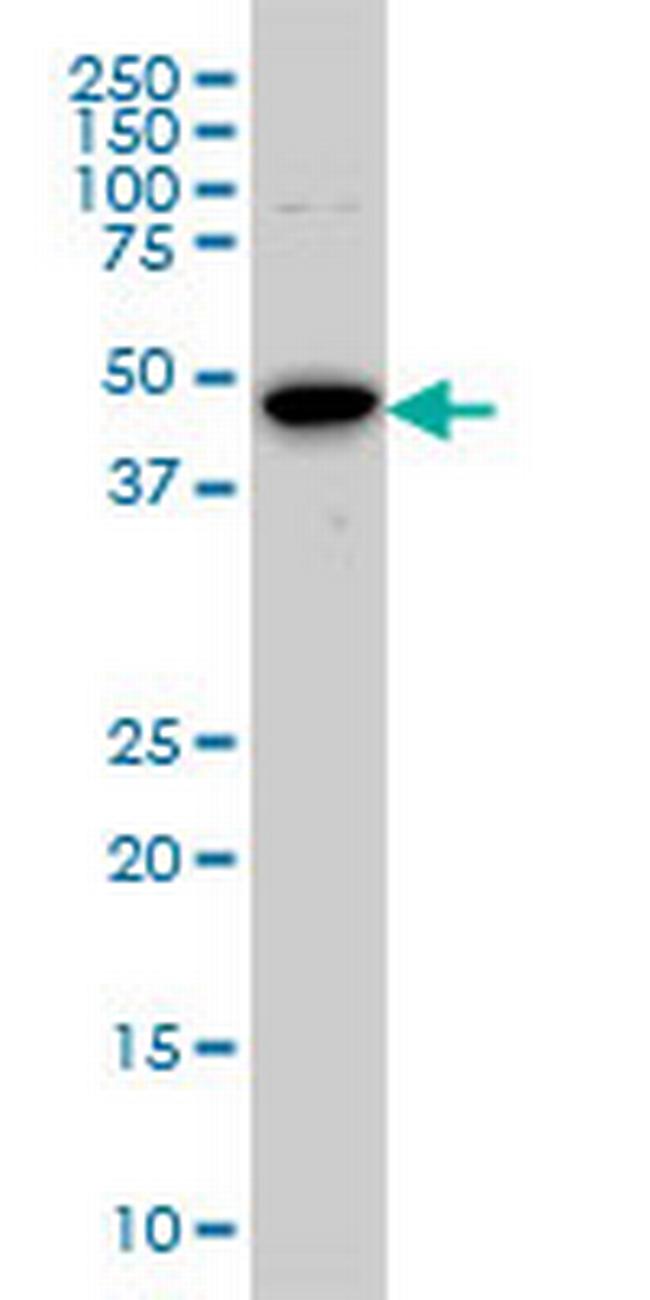 AURKA Antibody in Western Blot (WB)