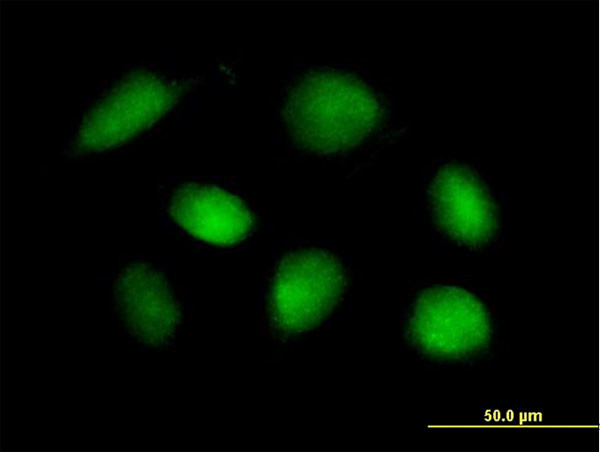 STK11 Antibody in Immunocytochemistry (ICC/IF)