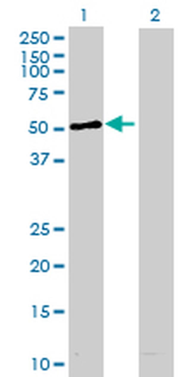 STK11 Antibody in Western Blot (WB)