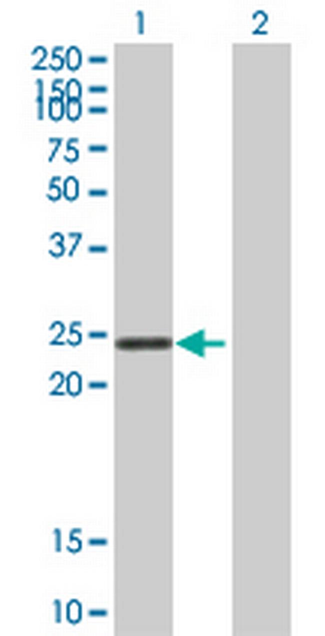 STYX Antibody in Western Blot (WB)