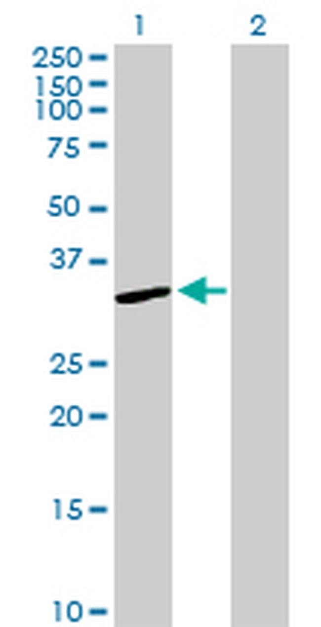 SULT1A1 Antibody in Western Blot (WB)