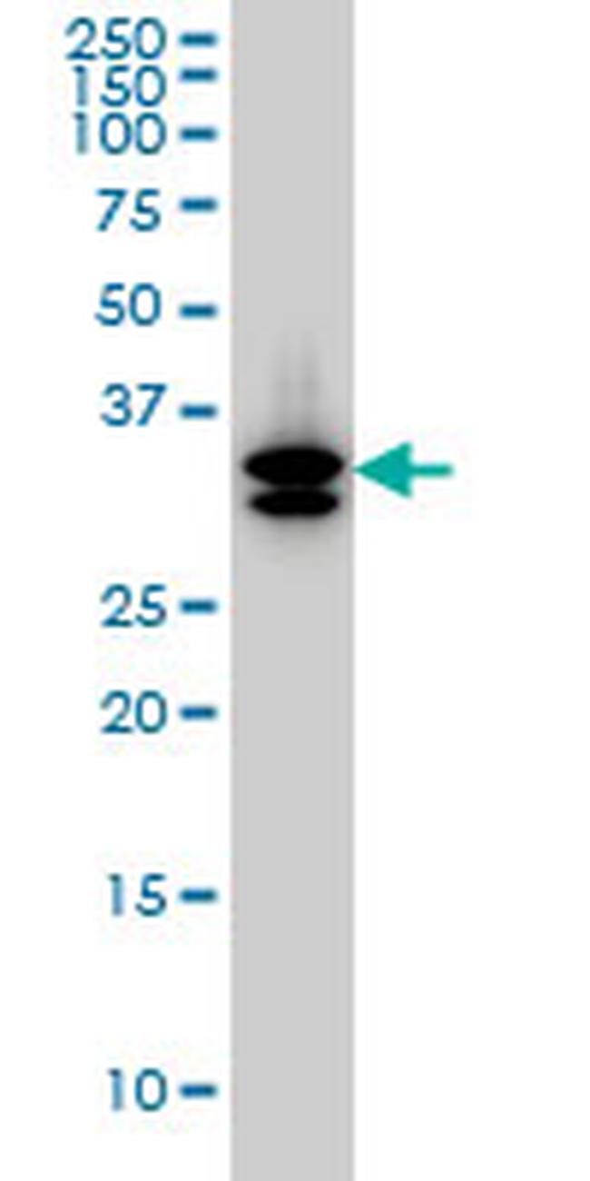 SULT1A3 Antibody in Western Blot (WB)