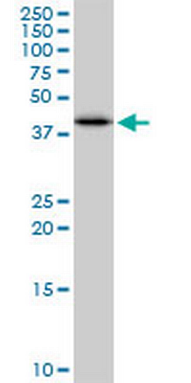 SULT2B1 Antibody in Western Blot (WB)