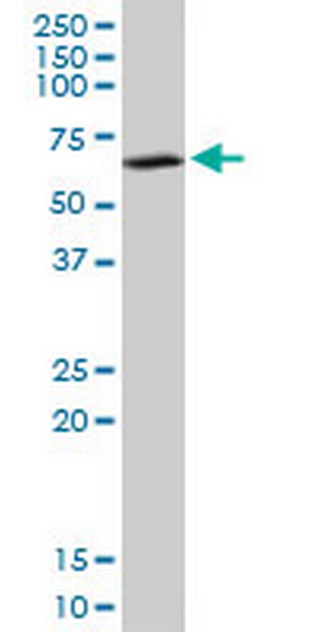 SUOX Antibody in Western Blot (WB)