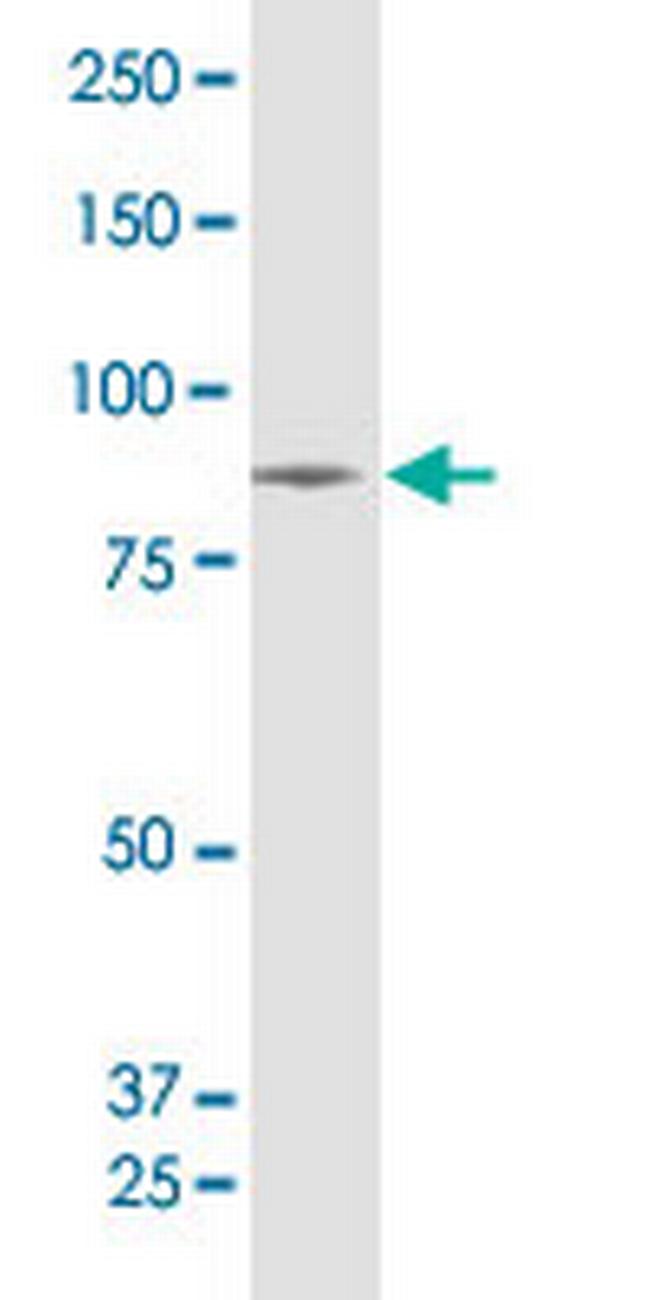 SUPV3L1 Antibody in Western Blot (WB)