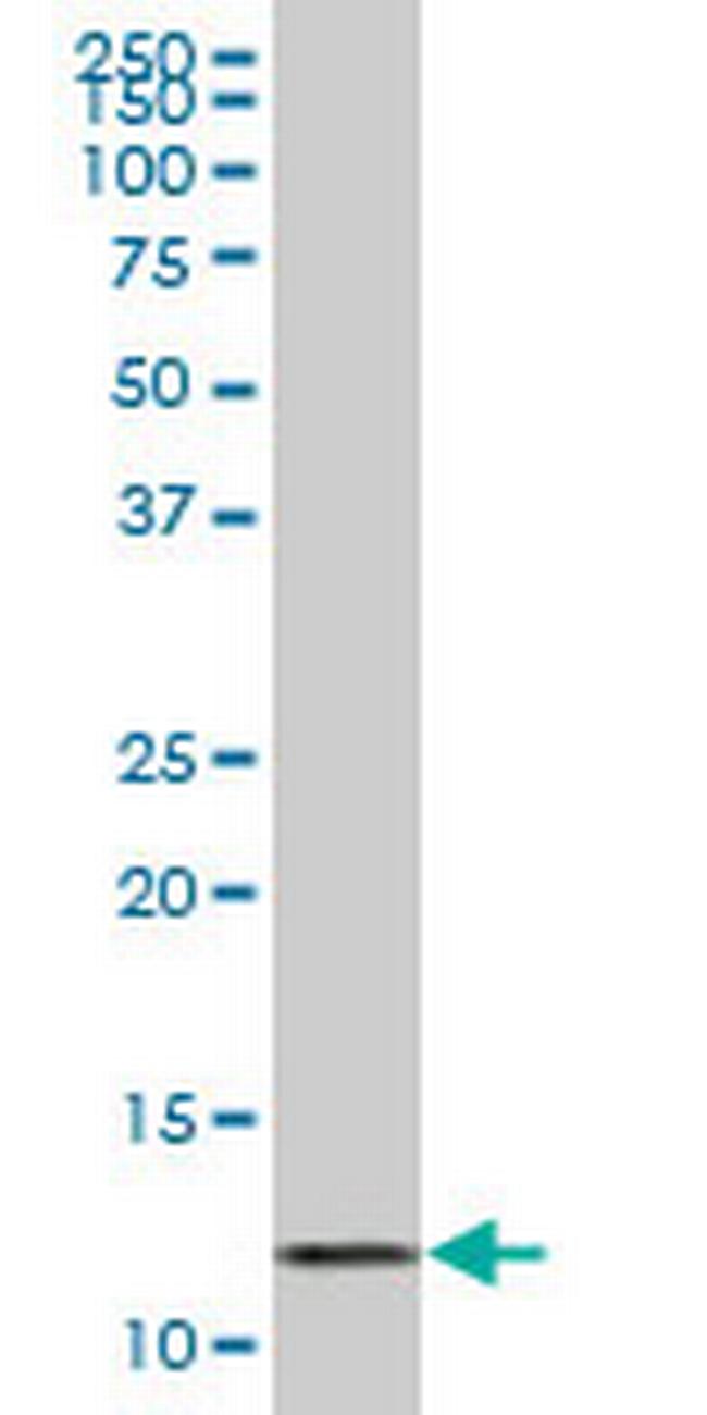 VAMP1 Antibody in Western Blot (WB)