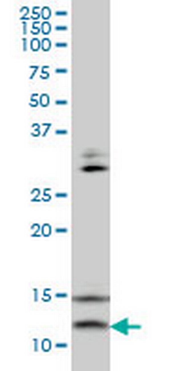 VAMP1 Antibody in Western Blot (WB)