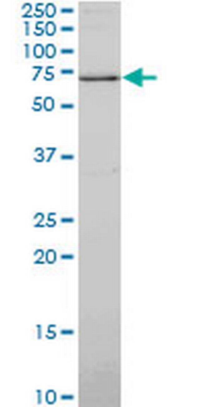 SYN1 Antibody in Western Blot (WB)