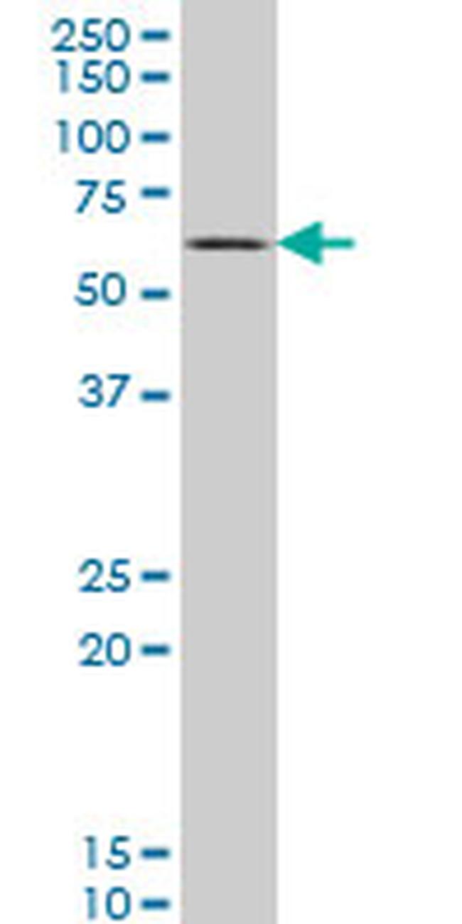 SYN1 Antibody in Western Blot (WB)