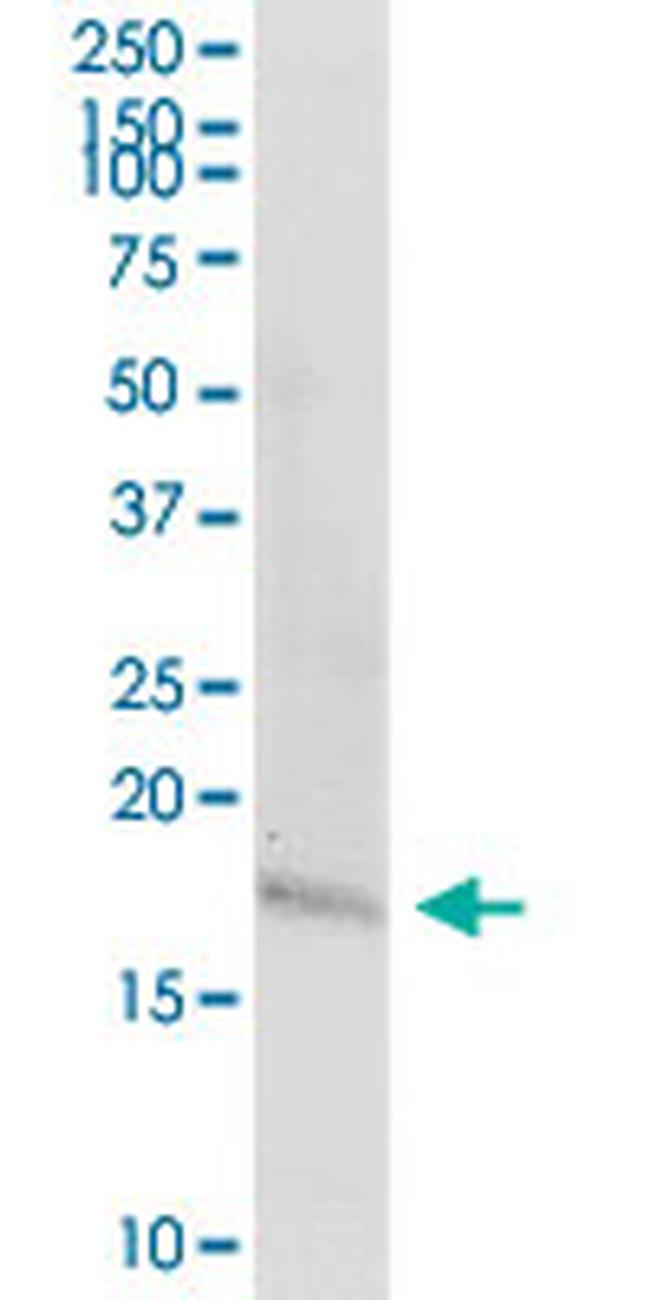 TAC1 Antibody in Western Blot (WB)