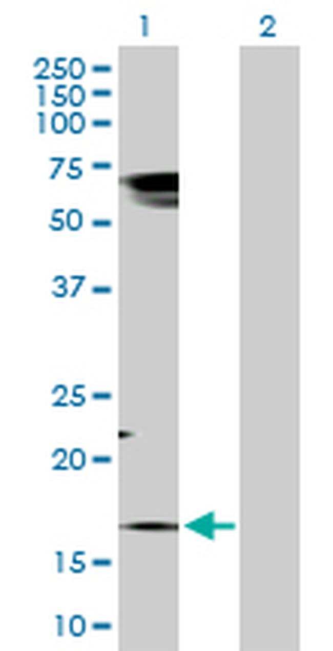 TAC1 Antibody in Western Blot (WB)