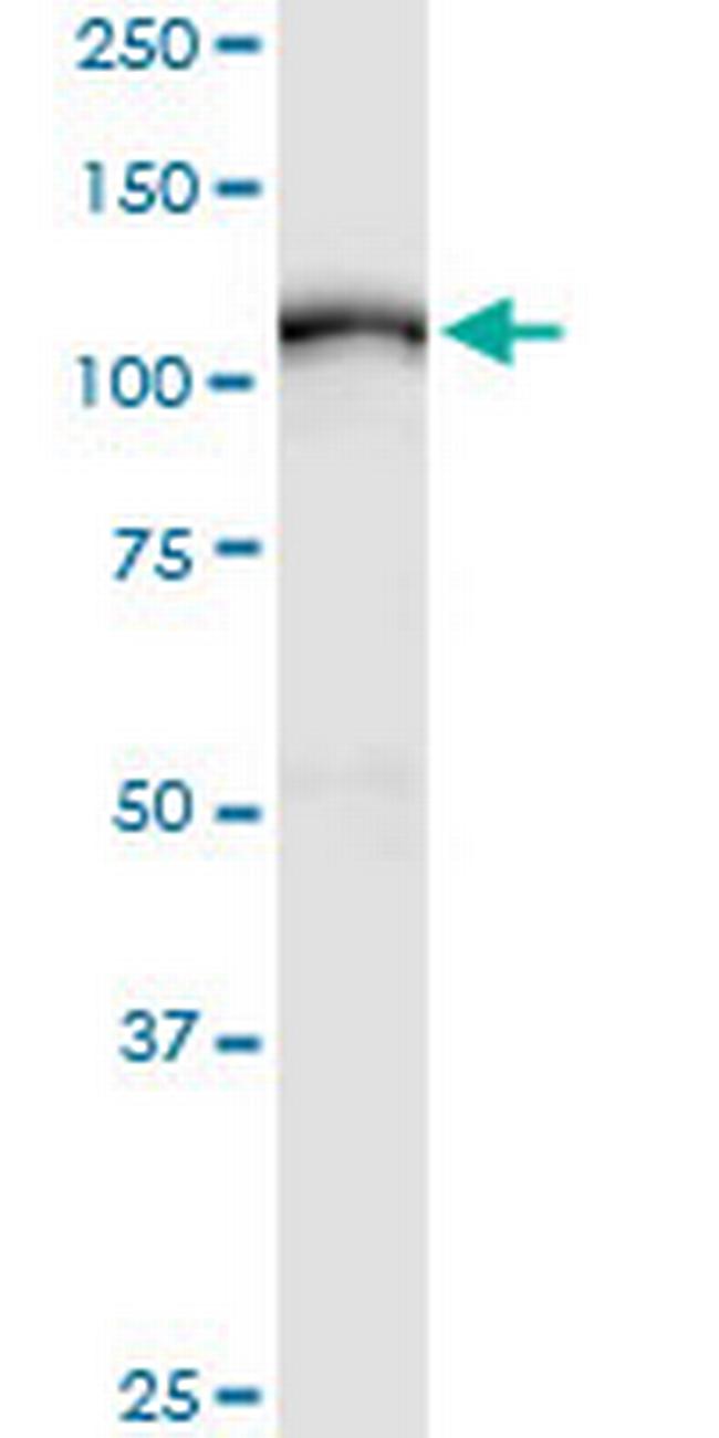 ADAM17 Antibody in Western Blot (WB)