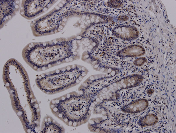 ADAM17 Antibody in Immunohistochemistry (Paraffin) (IHC (P))