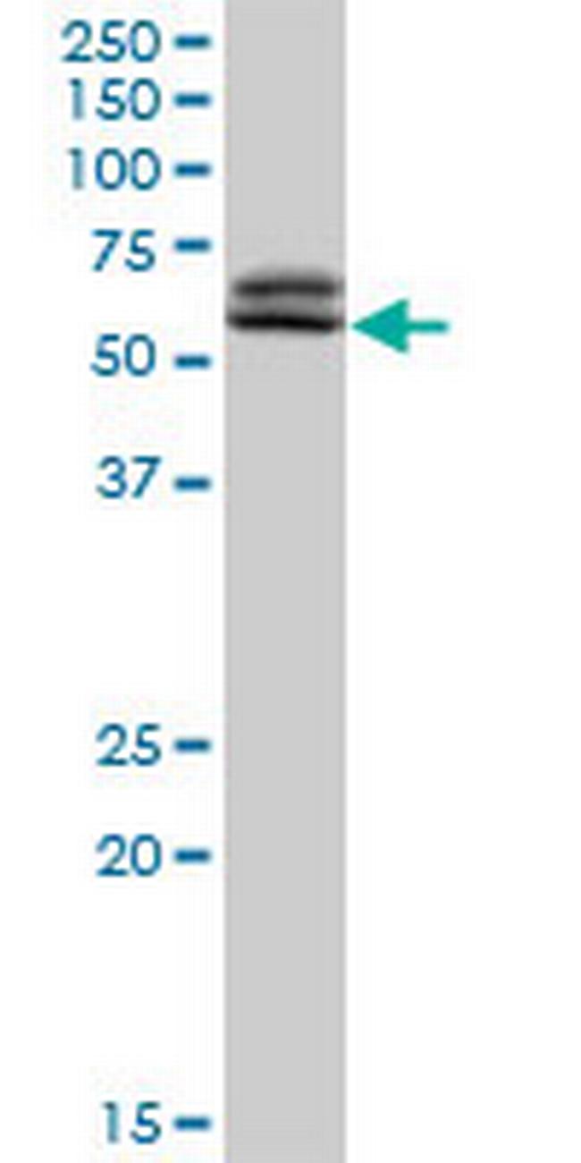 TAF6 Antibody in Western Blot (WB)