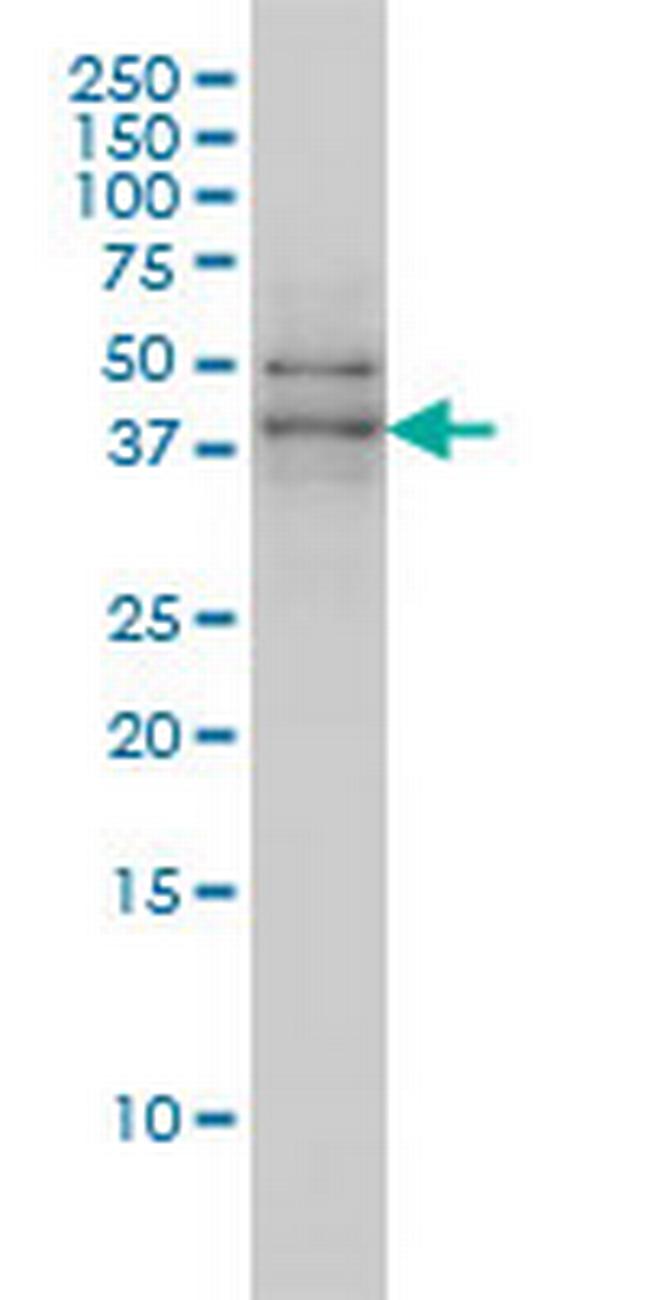 TAF7 Antibody in Western Blot (WB)