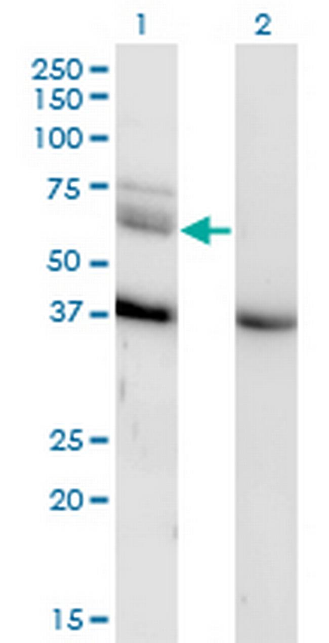 MAP3K7 Antibody in Western Blot (WB)