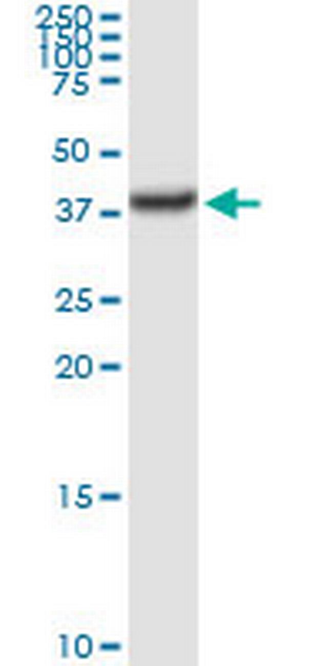 TALDO1 Antibody in Western Blot (WB)