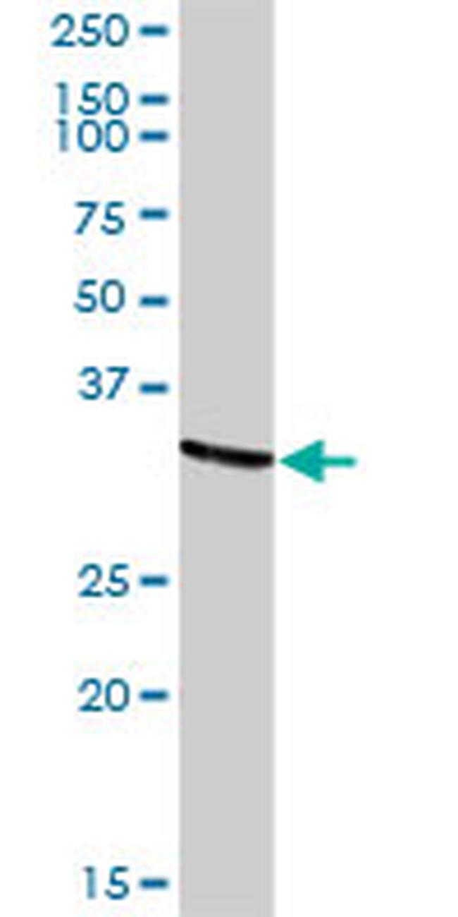 TARBP2 Antibody in Western Blot (WB)