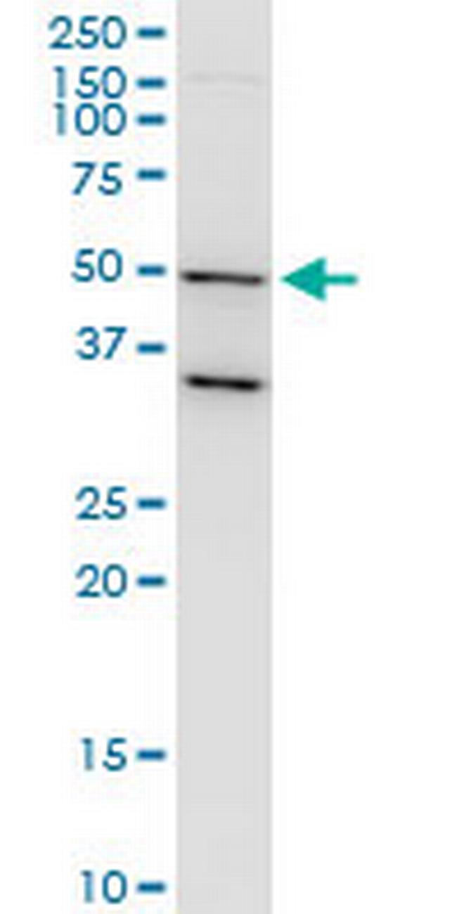 TARBP2 Antibody in Western Blot (WB)