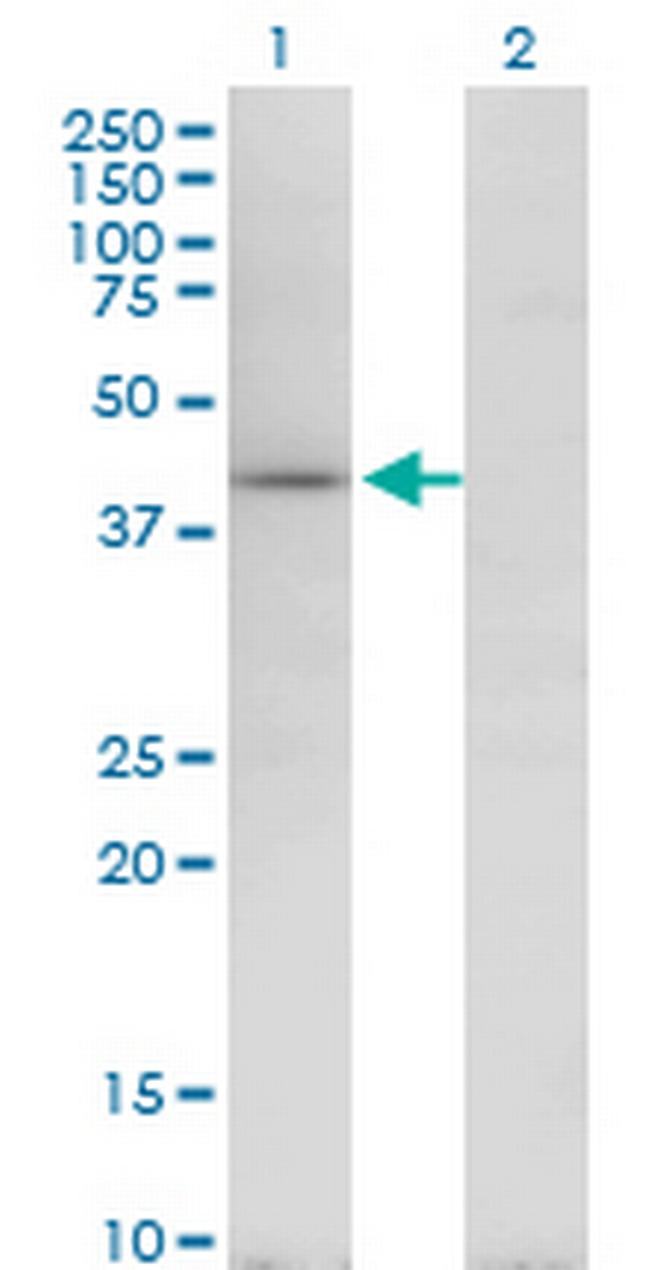 TARBP2 Antibody in Western Blot (WB)