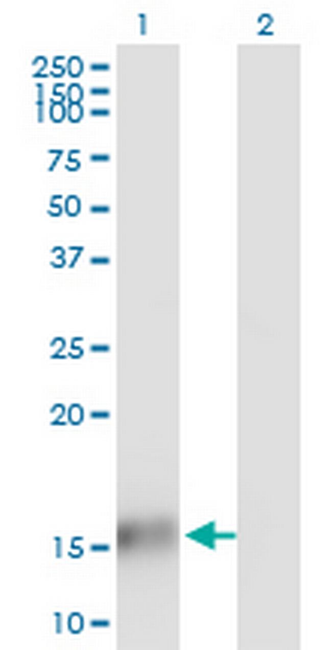 TBCA Antibody in Western Blot (WB)