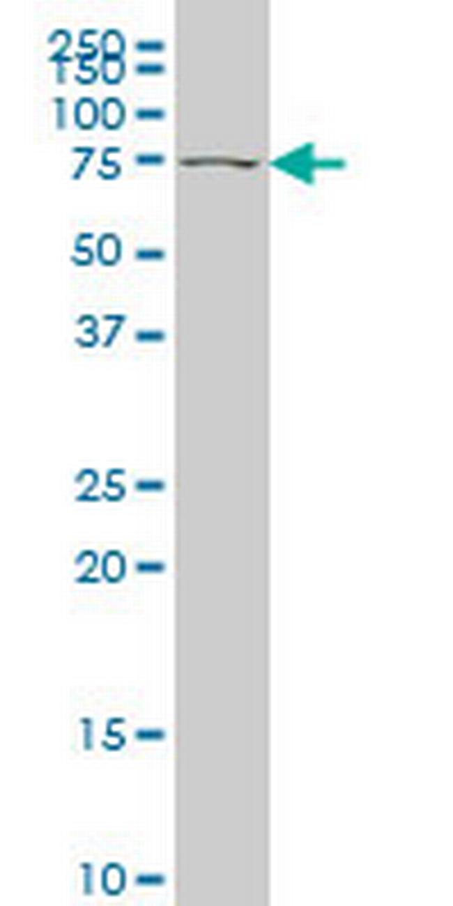 TBX2 Antibody in Western Blot (WB)