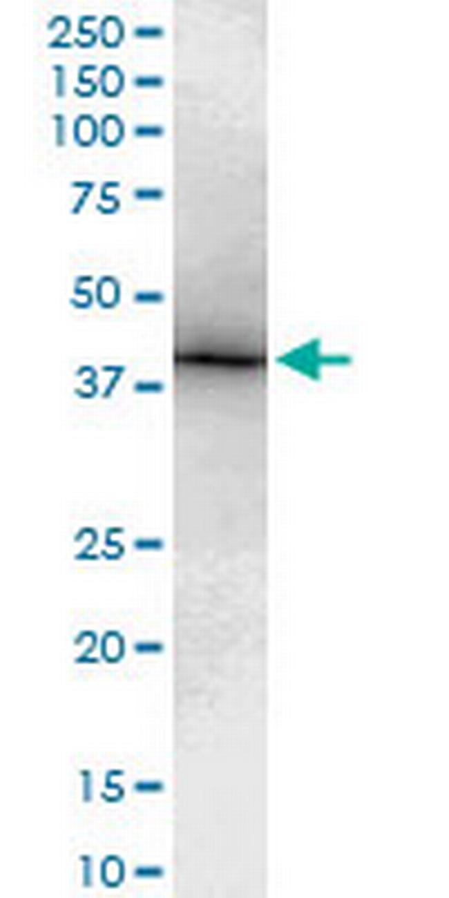 TBX6 Antibody in Western Blot (WB)