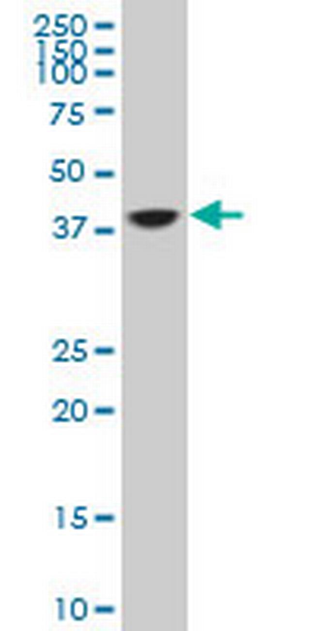 TCEA3 Antibody in Western Blot (WB)