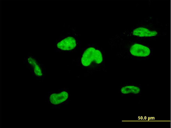 TCEA3 Antibody in Immunocytochemistry (ICC/IF)