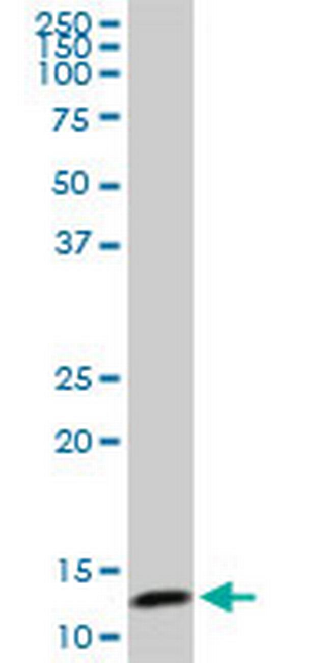 TCEB2 Antibody in Western Blot (WB)