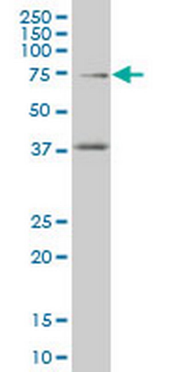 TCF4 Antibody in Western Blot (WB)