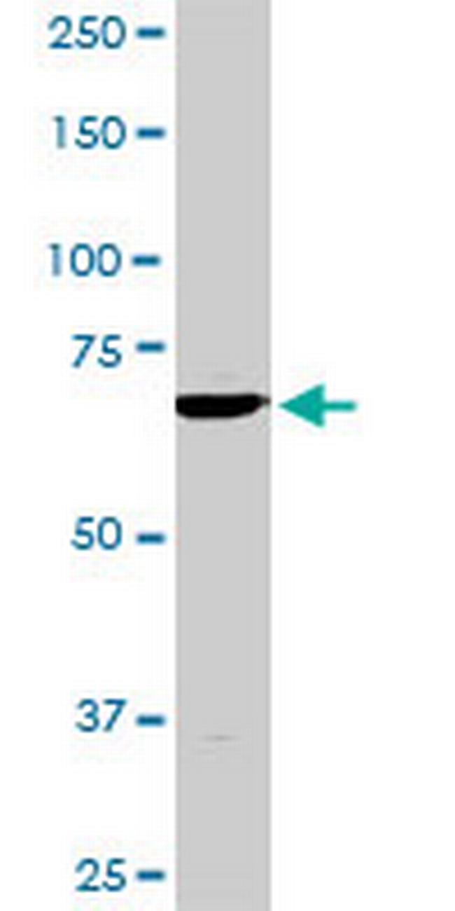 TBX3 Antibody in Western Blot (WB)