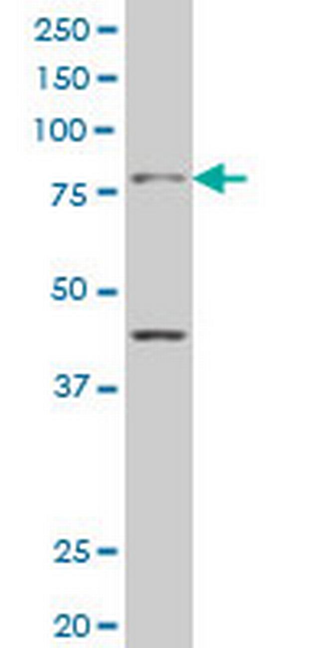 TBX3 Antibody in Western Blot (WB)