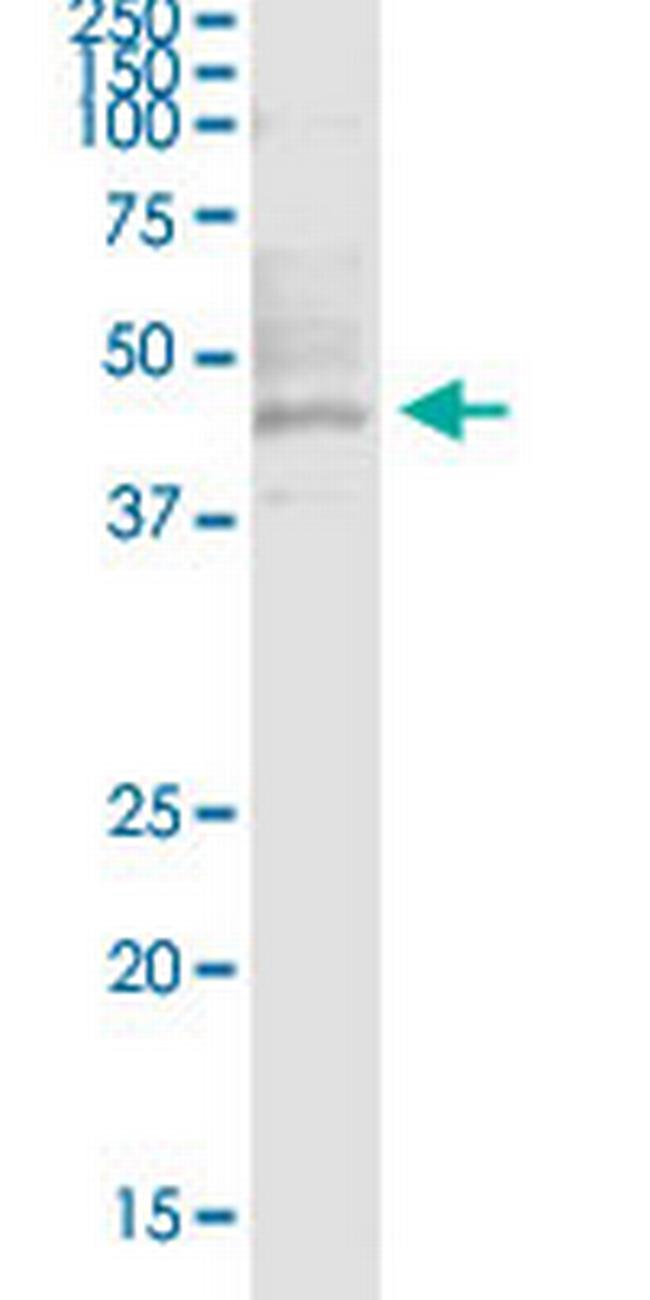 HNF1A Antibody in Western Blot (WB)