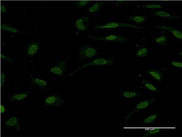 TCF2 Antibody in Immunocytochemistry (ICC/IF)